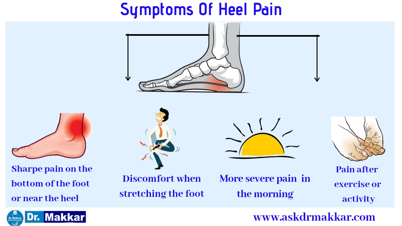 Calcaneal Spur Homeopathic Treatment Heel Pain Progressive Damage